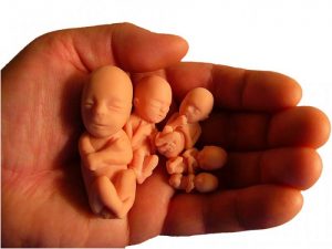 سقط جنین و وقایع ناگوار در زندگی بشریت