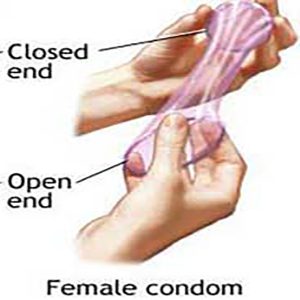 کاندوم زنانه